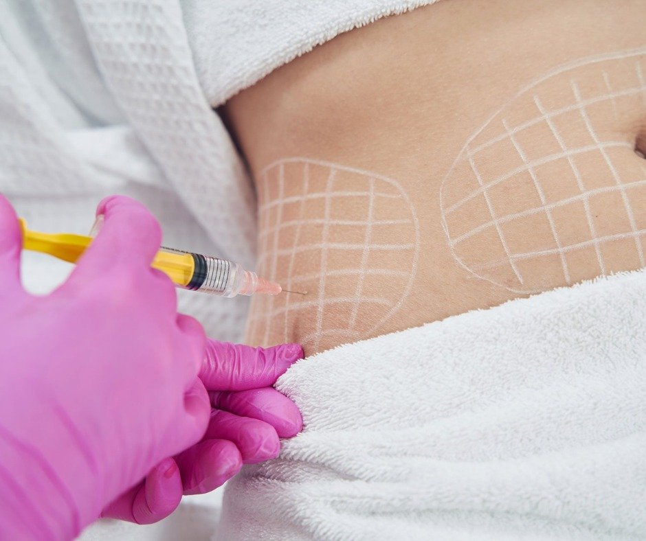 Fat Dissolving Injections